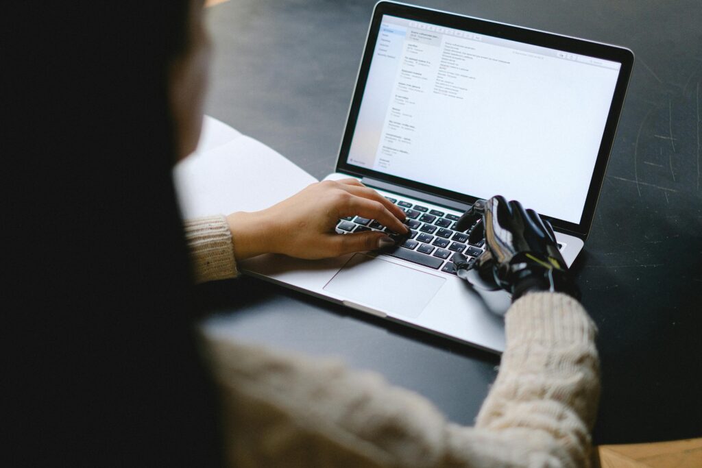 Mulher mexendo no computador com uma mão robótica.